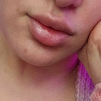 Blixi Nue